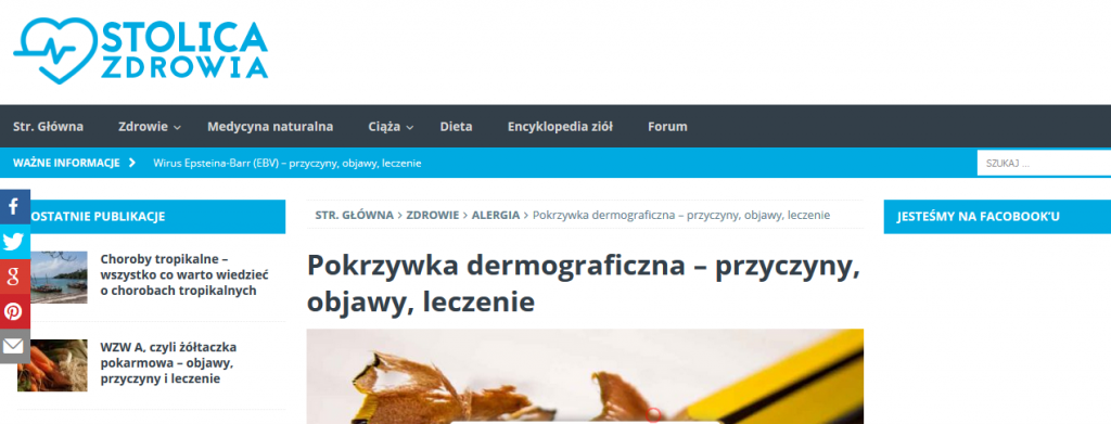 Pokrzywka dermograficzna – przyczyny, objawy, leczenie